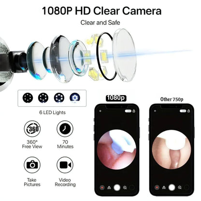 Ear Wax Removal, Ear Cleaner with Camera, Ear Wax Removal Kit with 1080P, Ear Camera Otoscope with Light, Ear Cleaning Kit with Cap for iPhone, iPad, Android Phones (Grey)